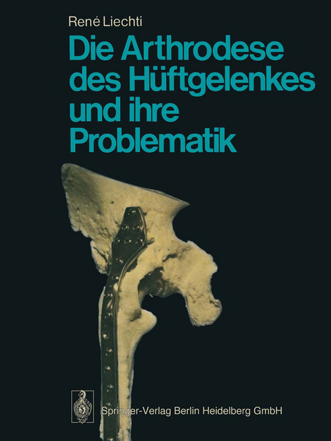 Die Arthrodese des Hüftgelenkes und ihre Problematik - R. Liechti