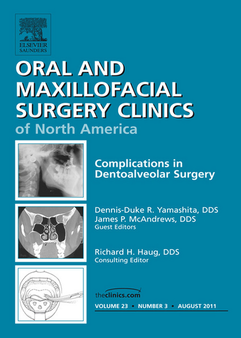 Dento-Alveolar Complications, An Issue of Oral and Maxillofacial Surgery Clinics -  Dennis-Duke R. Yamashita,  James P. McAndrews