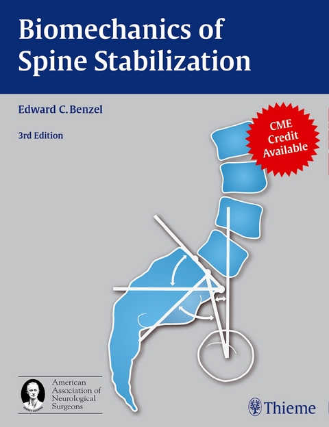 Biomechanics of Spine Stabilization - 