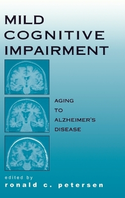 Mild Cognitive Impairment - 