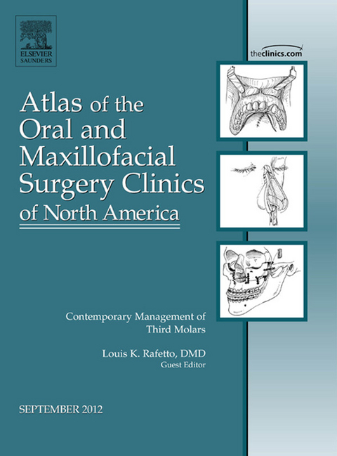 Contemporary Management of Third Molars, An Issue of Atlas of the Oral and Maxillofacial Surgery Clinics -  Louis K. Rafetto