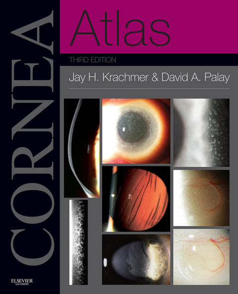 Cornea Atlas E-Book -  Jay H. Krachmer,  David A Palay