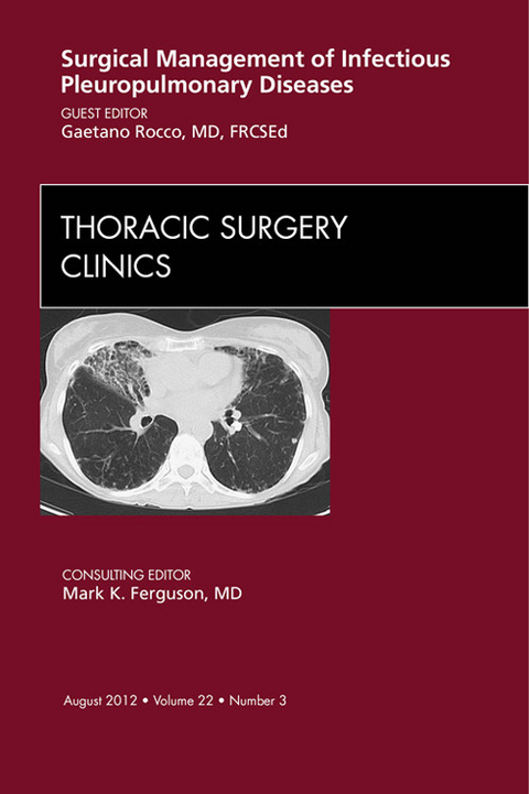 Surgical Management of Infectious Pleuropulmonary Diseases, An Issue of Thoracic Surgery Clinics -  Gaetano Rocco