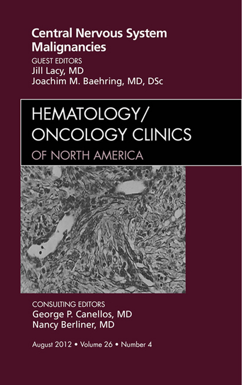 Central Nervous System Malignancies, An Issue of Hematology/Oncology Clinics of North America -  Jill Lacy,  Joachim M. Baehring