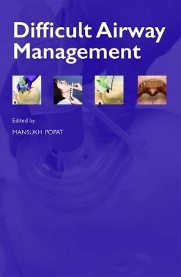 Difficult Airway Management - 