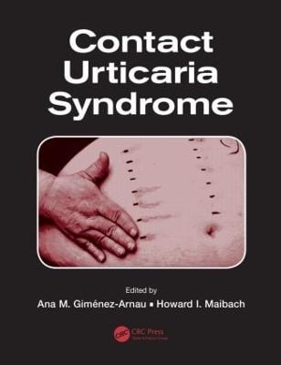 Contact Urticaria Syndrome - 