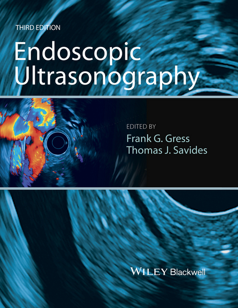 Endoscopic Ultrasonography - 