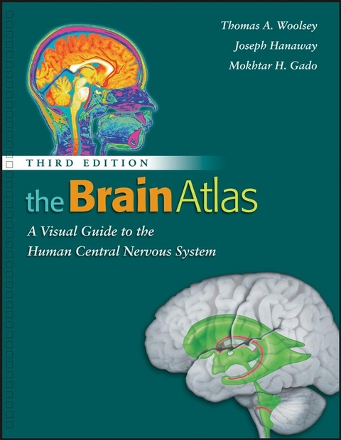 Brain Atlas - Thomas A. Woolsey, Joseph Hanaway, Mokhtar H. Gado