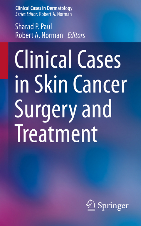 Clinical Cases in Skin Cancer Surgery and Treatment - 