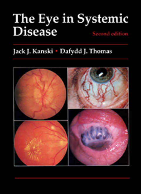 Eye in Systemic Disease -  Jack J. Kanski,  Dafydd J. Thomas