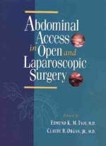 Abdominal Access in Open and Laparoscopic Surgery - 