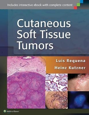 Cutaneous Soft Tissue Tumors - Luis Requena