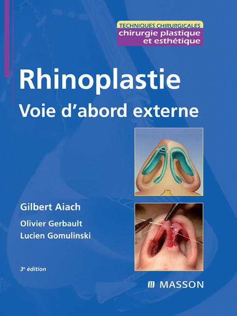 Rhinoplastie. Voie d'abord externe -  Gilbert Aiach