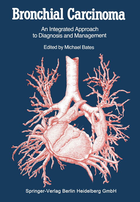 Bronchial Carcinoma - 