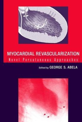 Myocardial Revascularization: Novel Percutaneous A Approaches - GS Abela