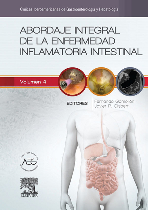 Abordaje integral de la enfermedad inflamatoria intestinal - 