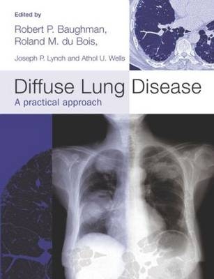 Diffuse Lung Disease - Robert P Baughman