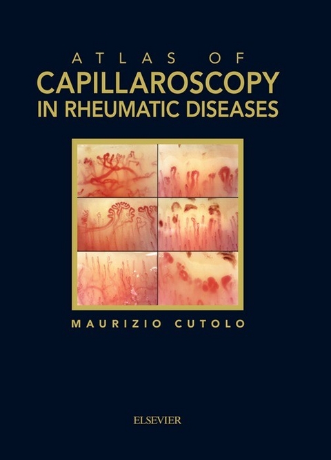 Atlas of capillaroscopy in rheumatic diseases - 