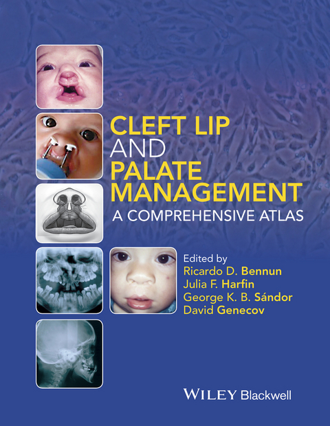 Cleft Lip and Palate Management - George K. B. Sándor, David Genecov