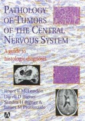 Pathology of Tumors of the Central Nervous System - James Provenzale, Darell Bigner, Sandra Bigner, Roger McLendon