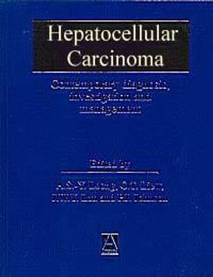 Hepatocellular Carcinoma