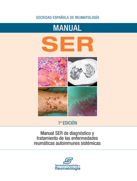 Manual SER de diagnóstico y tratamiento de las enfermedades reumáticas autoinmunes sistémicas - 