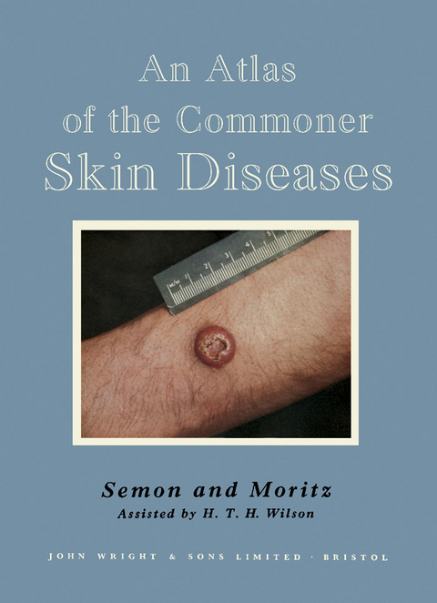 Atlas of the Commoner Skin Diseases -  Henry C. G. Semon