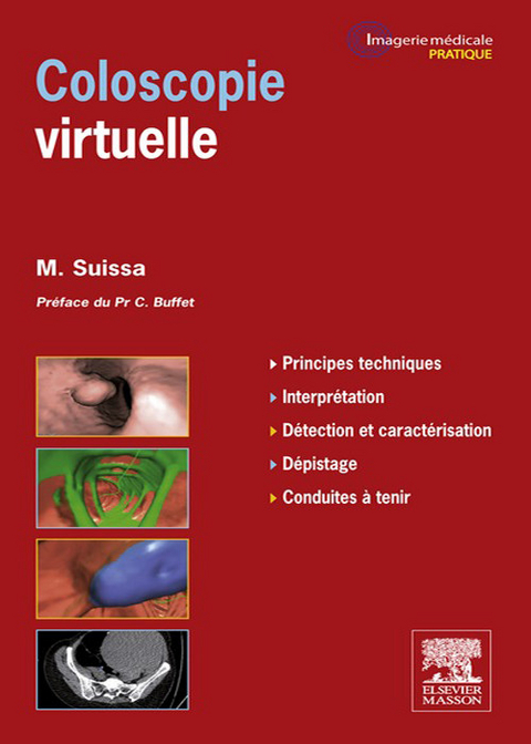 Coloscopie virtuelle -  Mickael Suissa