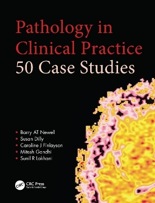 Pathology in Clinical Practice: 50 Case Studies - Barry AT Newell, Susan Dilly, Caroline Finlayson, Mitesh Gandhi, Sunil Lakhani