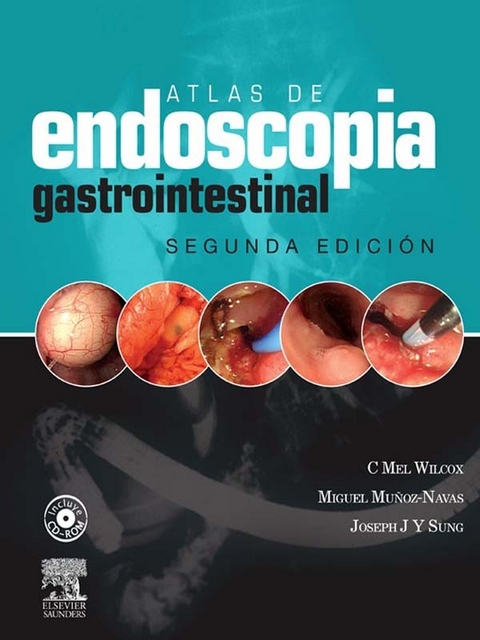 Atlas de Endoscopia Gastrointestinal Clinica -  Charles Melbern Wilcox,  Miguel Munoz-Navas,  Joseph J Y Sung