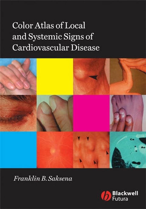 Color Atlas of Local and Systemic Manifestations of Cardiovascular Disease - Franklin B. Saksena