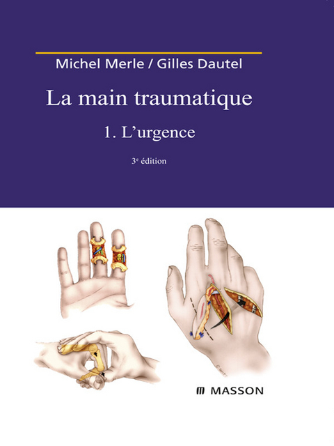 La Main traumatique. Tome 1. L'Urgence -  Michel Merle,  Gilles Dautel