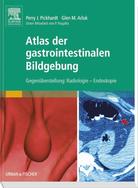 Atlas der gastrointestinalen Bildgebung - Perry J. Pickhardt, Glen M. Arluk