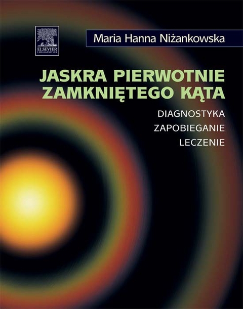 Jaskra pierwotnie zamknietego kata. Diagnostyka, zapobieganie, leczenie -  Hanna Maria Nizankowska