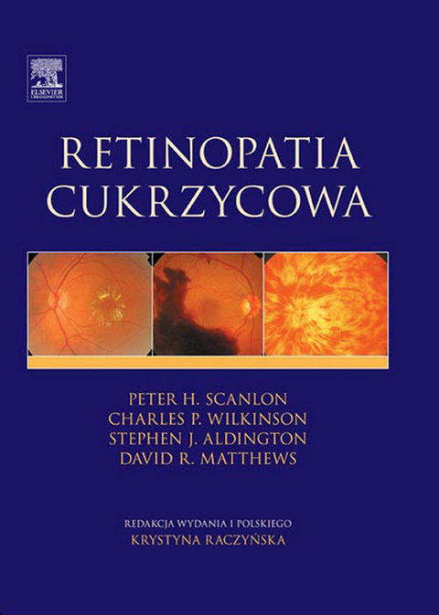 Retinopatia cukrzycowa -  Peter H. Scanlon,  Charles P Wilkinson,  S. Aldington