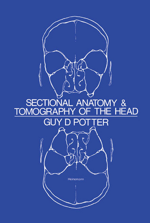 Sectional Anatomy and Tomography of the Head -  Guy D. Potter