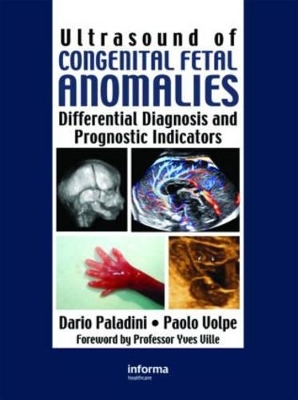 Ultrasound of Congenital Fetal Anomalies - Dario Paladini, Paolo Volpe