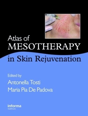 Atlas of Mesotherapy in Skin Rejuvenation - 