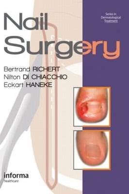 Nail Surgery - 