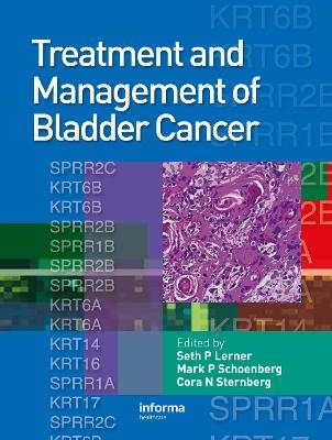 Treatment and Management of Bladder Cancer - 