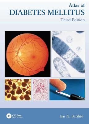 Atlas of Diabetes Mellitus - Ian N. Scobie