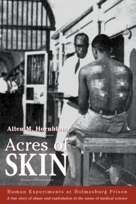 Acres of Skin - Allen M. Hornblum