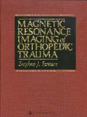 Magnetic Resonance Imaging of Orthopedic Trauma - Stephen John Eustace