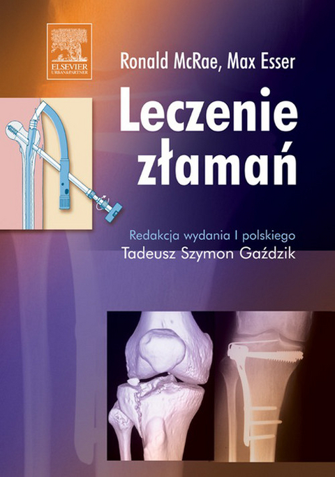 Leczenie zlaman -  Ronald McRae