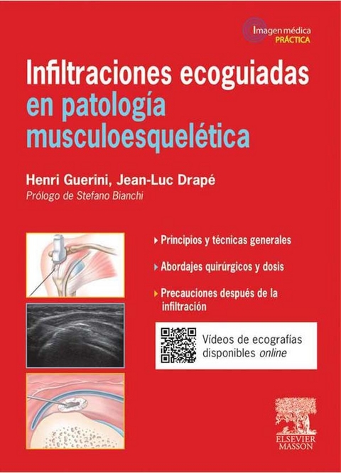 Infiltraciones ecoguiadas en patología musculoesquelética -  Jean-Luc Drape,  Henri Guerini