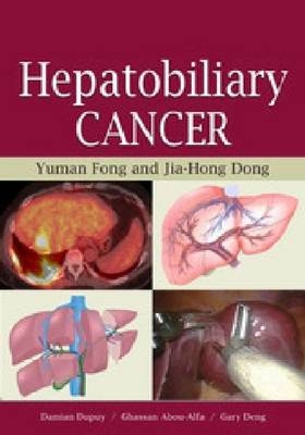 Hepatobiliary Cancer - Yuman Fong, Leslie Blumgart