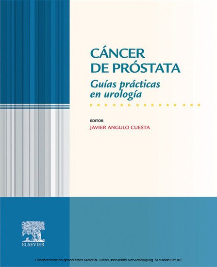 Cáncer de próstata -  Javier Angulo Cuesta