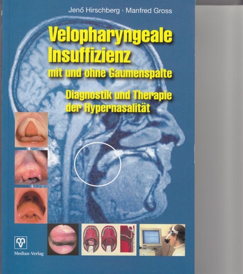 Velopharyngeale Insuffizienz mit und ohne Gaumenspalte - Jenö Hirschberg, Manfred Gross