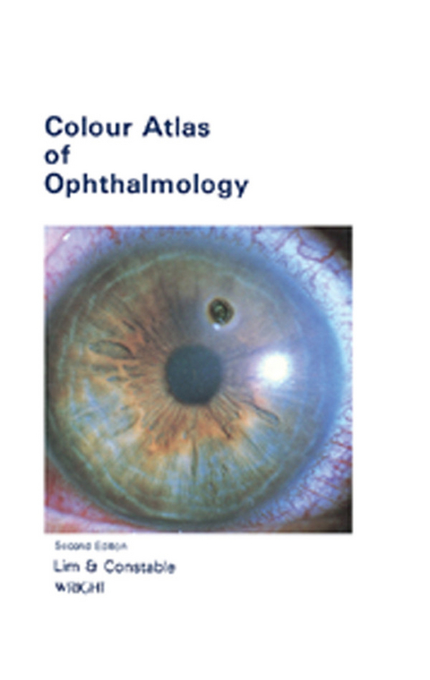 Colour Atlas of Ophthalmology -  Ian J Constable,  Arthur Lim Siew Ming