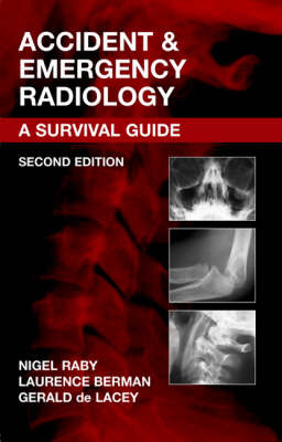 Accident and Emergency Radiology - Nigel Raby, Laurence Berman, Gerald De Lacey